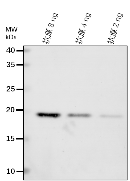 Anti-KEG/ RING-type E3 ubiquitin transferase