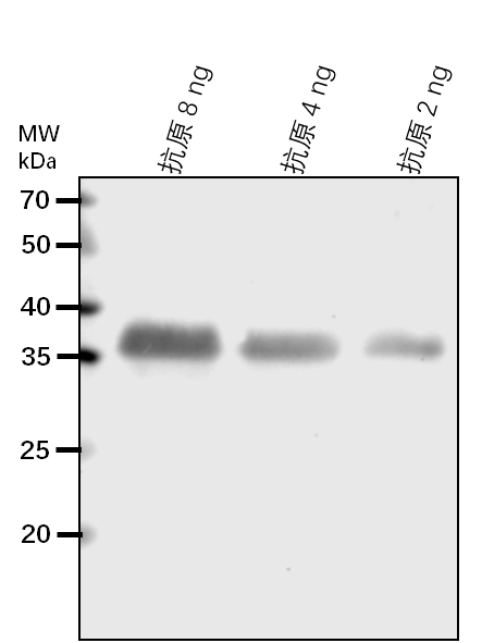 Anti-ISPE/ 4-diphosphocytidyl-2-C-methyl-D-erythritol kinase