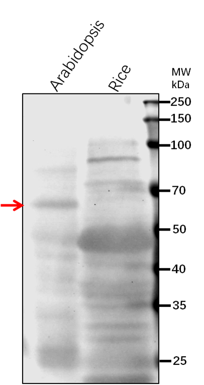 Anti-PLC2/ Phosphoinositide phospholipase C