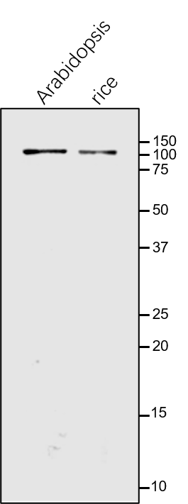 Anti-GLDP / Glycine decarboxylase complex P protein