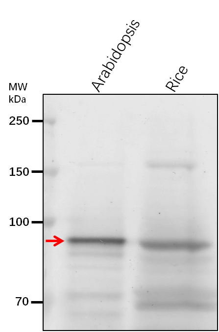 RPN1A
