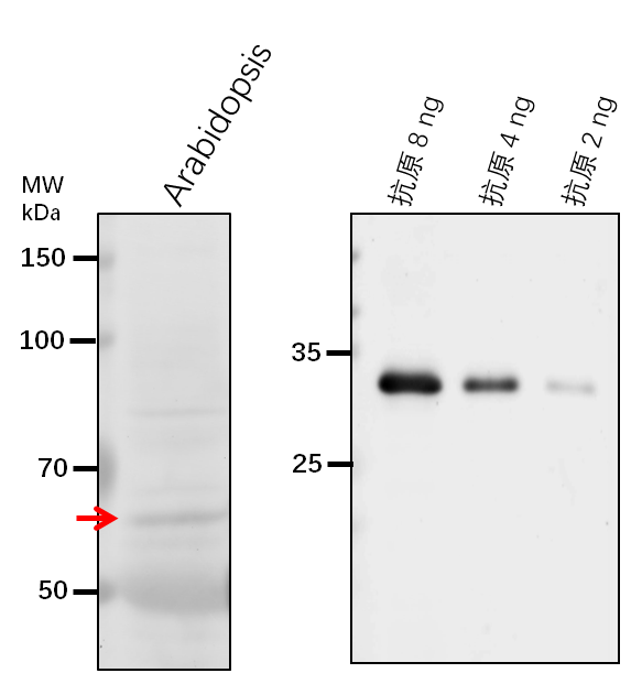 Anti-VPS45/ Vacuolar protein sorting-associated protein 45 homolog