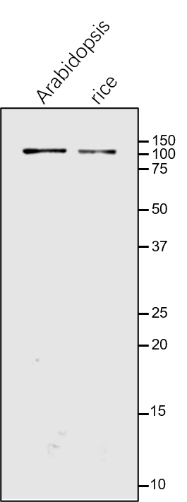 Anti-GLDP / Glycine decarboxylase complex P protein