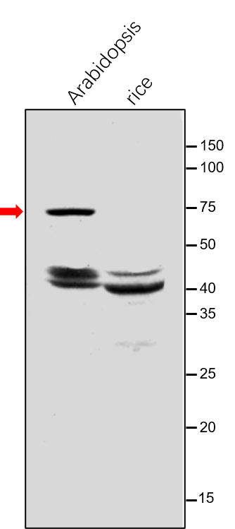 Anti-DXS / 1-deoxy-D-xylulose-5-phosphate synthase