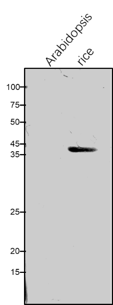 Anti-FBA / Fructose-bisphospate aldolase isozyme antibody