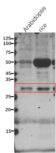 Anti-SK2 / Shikimate kinase 2 antibody