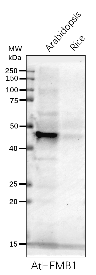 Anti- HEMB1/ALAD1/ Delta-aminolevulinic acid dehydratase 1