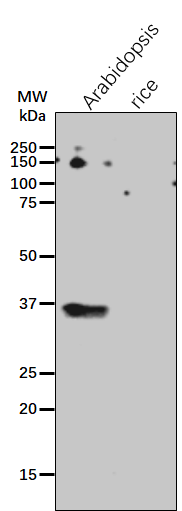 Anti-CAS/ Calcium Sensing Receptor antibody