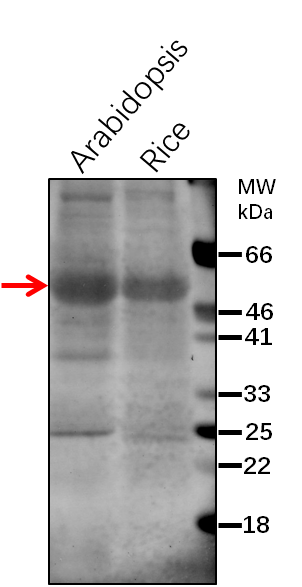 Anti-HXK1/ Hexokinase-1 Rabbit Antibody