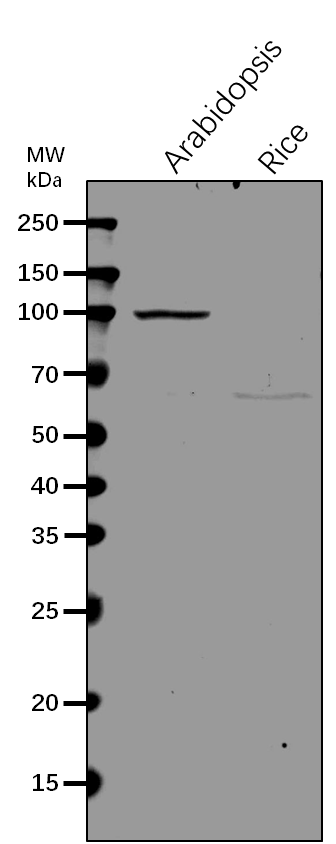 Anti-NAA15/N-terminal acetyltransferase A complex auxiliary