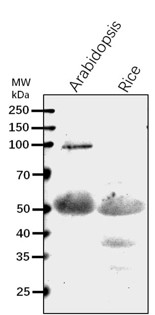 Anti-F2KP/ Fructose-2,6-bisphosphatase