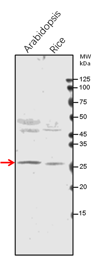 Anti-GAMMA CA1/ Gamma carbonic anhydrase 1，mitochondrial