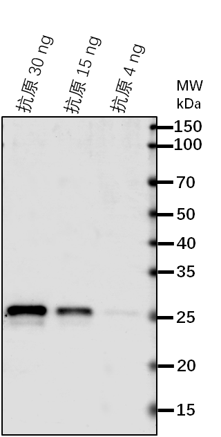 Anti-OMP85/ Outer membrane OMP85 family protein