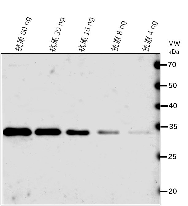 Anti-PECT1/ Ethanolamine-phosphate cytidylyltransferase