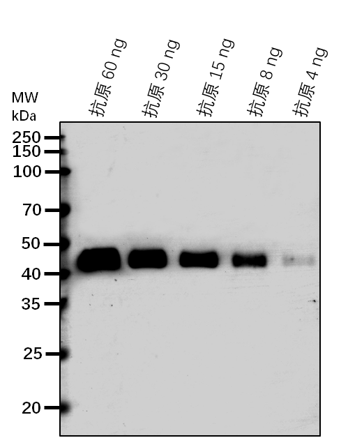 Anti-WIP1/ WPP domain-interacting protein 1