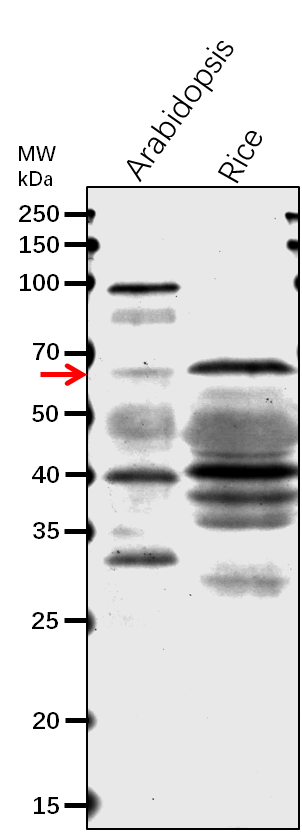 Anti-TIC62/ Protein TIC 62