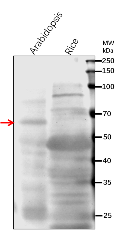 Anti-PLC2/ Phosphoinositide phospholipase C