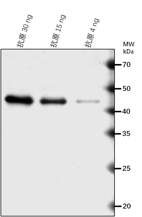 Anti-zpu1/ pullulanase-type starch debranching enzyme1