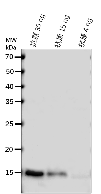 Anti-CCS/ Copper chaperone for superoxide dismutase