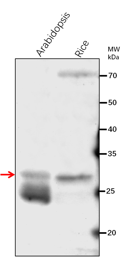 Anti-KR/ 3-oxoacyl-[acyl-carrier-protein] reductase