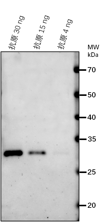 Anti-TIR1/ Protein TRANSPORT INHIBITOR RESPONSE 1