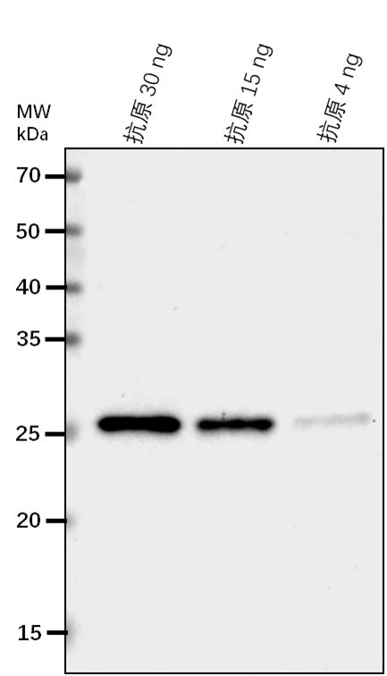 Anti-DHQS/ 3-dehydroquinate synthase, chloroplastic