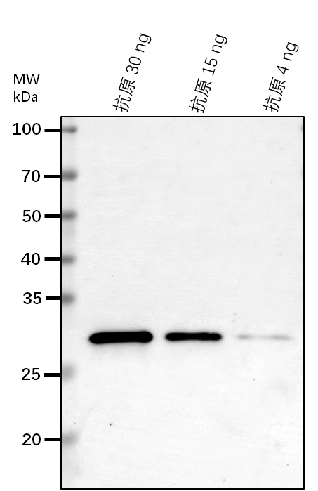 Anti-RPOB/ DNA-directed RNA polymerase subunit beta