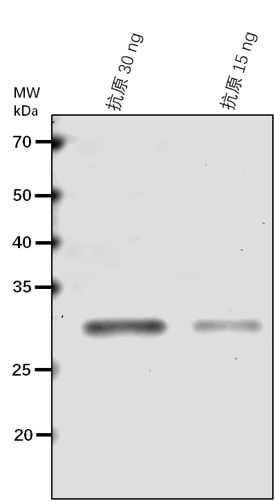 Anti-NOL/ Chlorophyll(ide) b reductase NOL, chloroplastic