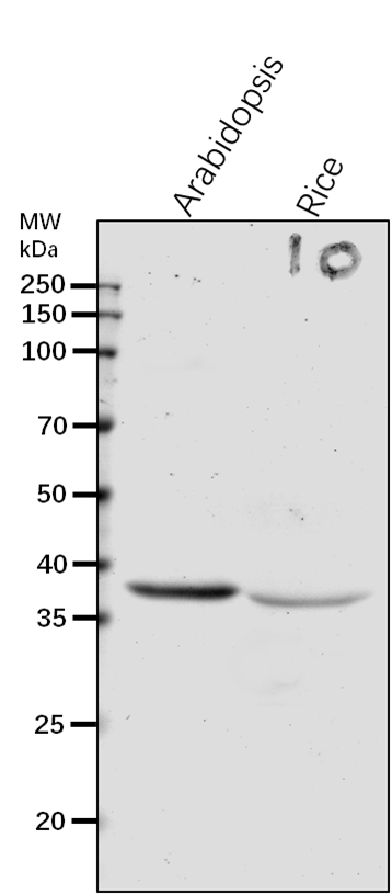 Anti-SSI2/ Stearoyl-[acyl-carrier-protein] 9-desaturase 7