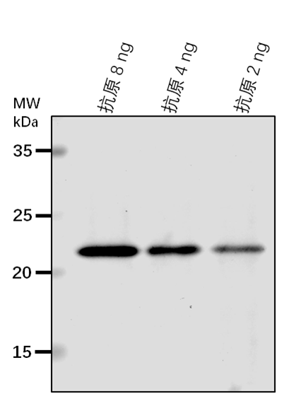 Anti-ECT4/ YTH domain-containing protein ECT4