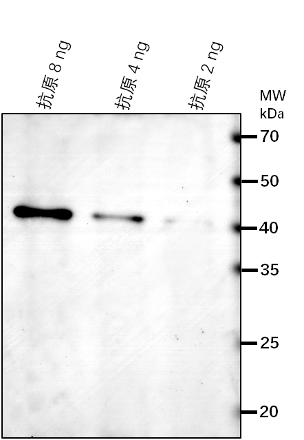 Anti-FRK1/ FLG22-induced receptor-like kinase 1