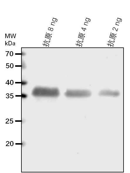 Anti-ISPE/ 4-diphosphocytidyl-2-C-methyl-D-erythritol kinase