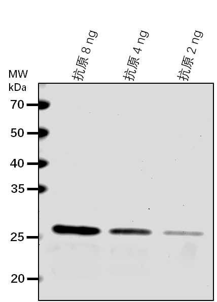 Anti-IPP2/ Isopentenyl-diphosphate Delta-isomerase II