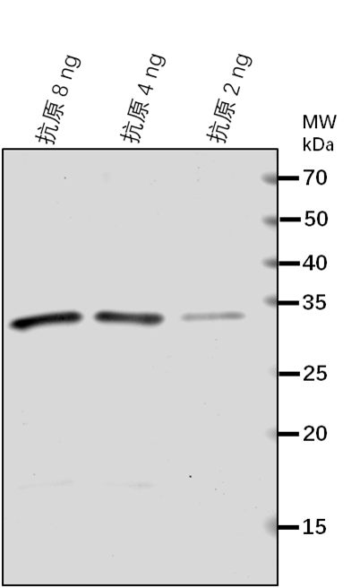 Anti-BAK1/ BRASSINOSTEROID INSENSITIVE 1-associated receptor