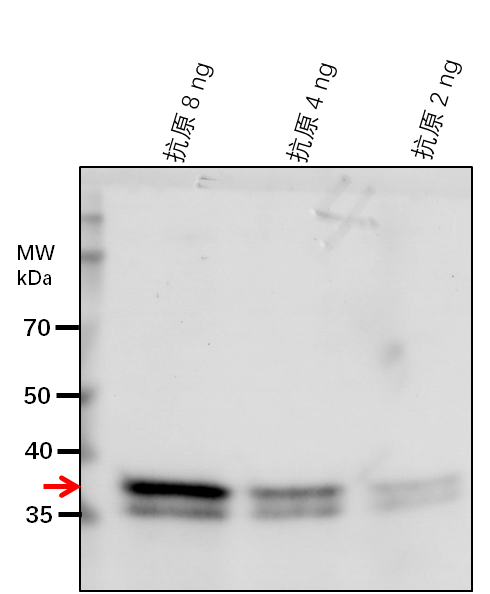 Anti-HDC1/ Uncharacterized protein At5g08450