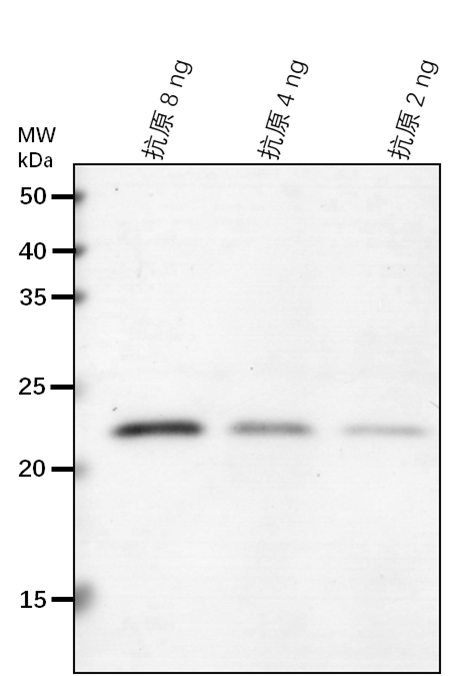 Anti-HEMD/ Uroporphyrinogen-III synthase, chloroplastic