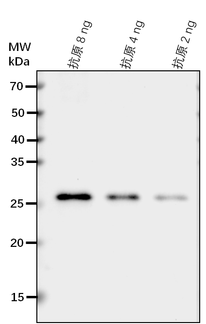 Anti-MKP1/ Protein-tyrosine-phosphatase MKP1