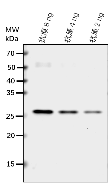 Anti-NPR1/ BTB/POZ domain and ankyrin repeat-containing prot