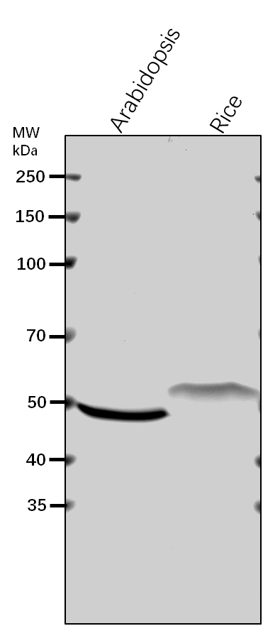 Anti-UGP2/ UTP--glucose-1-phosphate uridylyltransferase 2