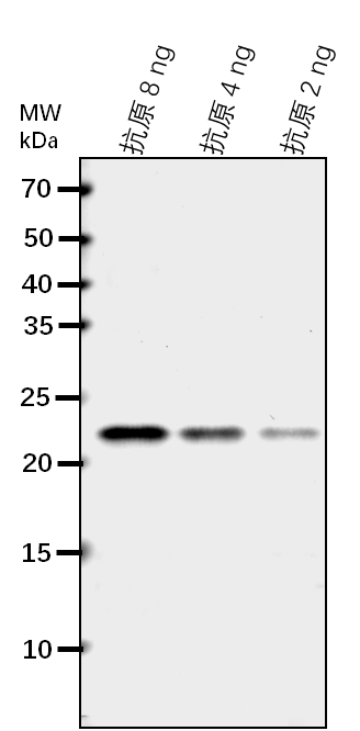 Anti-BCAT3/ Branched-chain-amino-acid aminotransferase