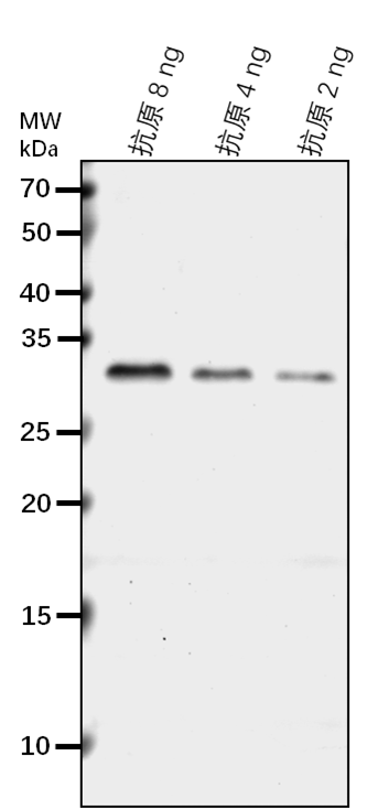 Anti-Receptor-like serine/threonine-protein kinase