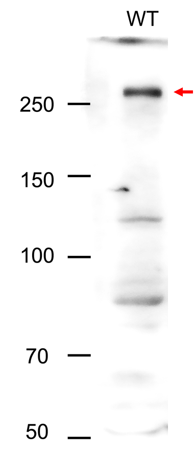 Anti-TOR/ Serine/threonine-protein kinase TOR