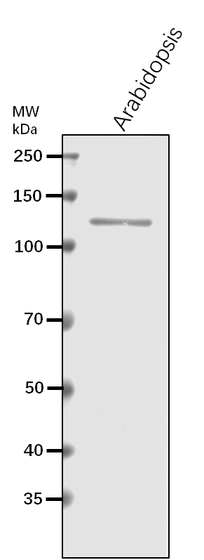 Anti-SPS1/ Sucrose-phosphate synthase 1