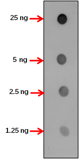 Anti-ACBP1/ Acyl-CoA-binding domain-containing protein 1