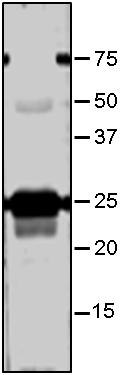 Anti-Lhcb5/ Chlorophyll a-b binding protein CP26 antibody