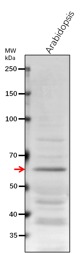 Anti-P5CDH/ P5C dehydrogenase, mitochondrial