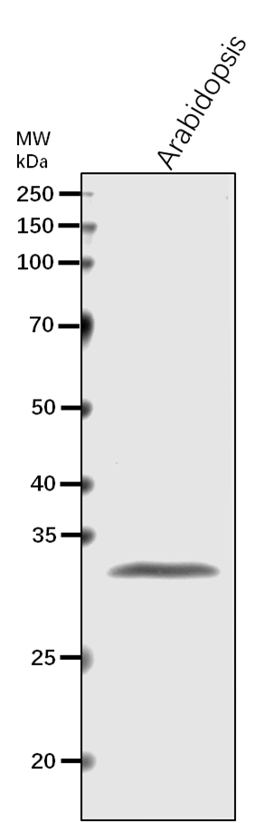 Anti-rps5/ Small ribosomal subunit protein uS5c