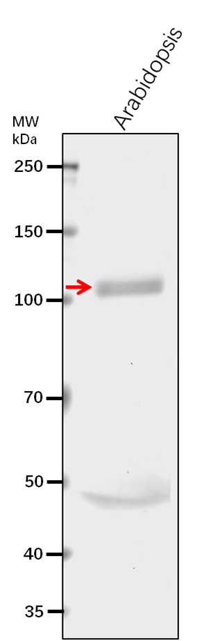 Anti-CESA1/ Cellulose synthase A catalytic subunit 1 [UDP-fo