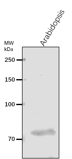 Anti-CRS1/ Chloroplastic RNA splicing factor 1