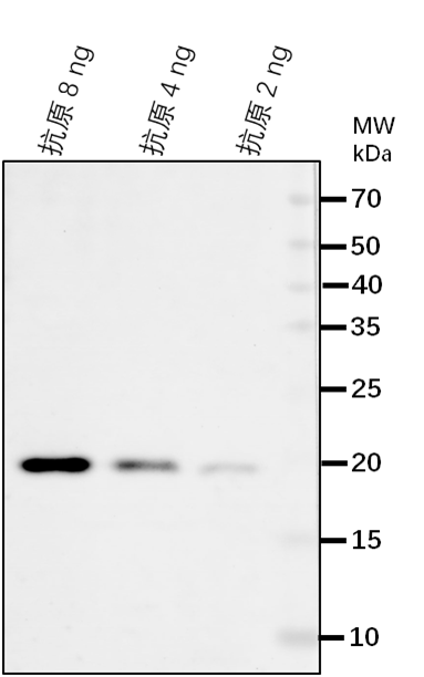 Anti-ELP2/ Elongator complex protein 2